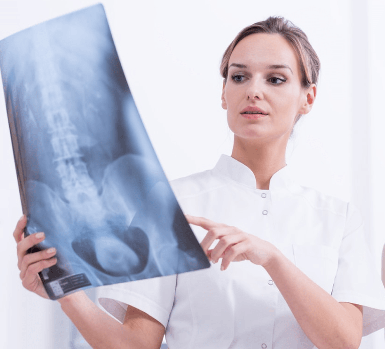 Diagnostic de l'ostéochondrose thoracique par examen radiographique